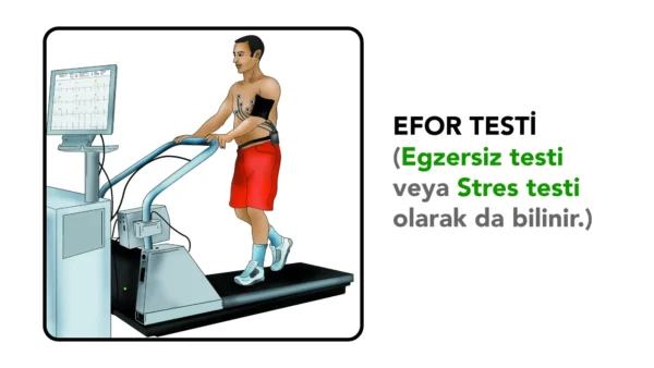 Efor testi (egzersiz testi veya stres testi)