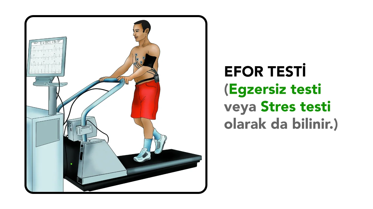 Efor testi (egzersiz testi veya stres testi)
