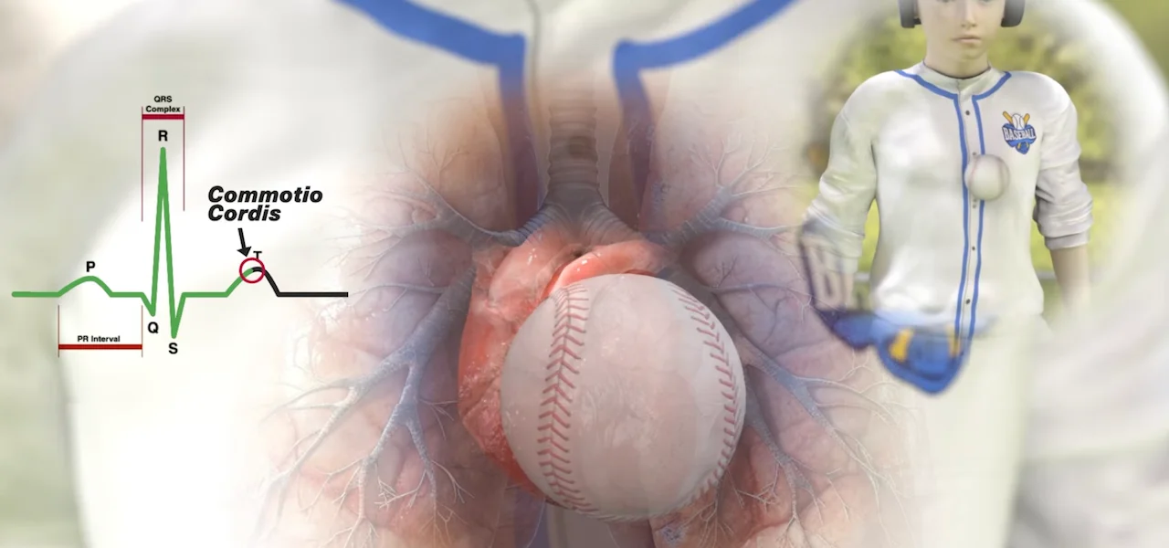 Göğse gelen sert darbe kalp ritmini bozabilir mi? Commotio cordis nedir?